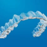 Protecting Your Smile After Invisalign